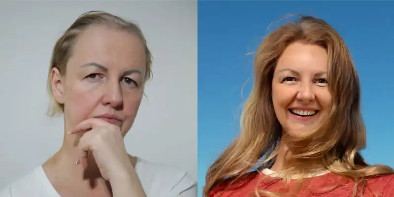 Before and after — Lena P.