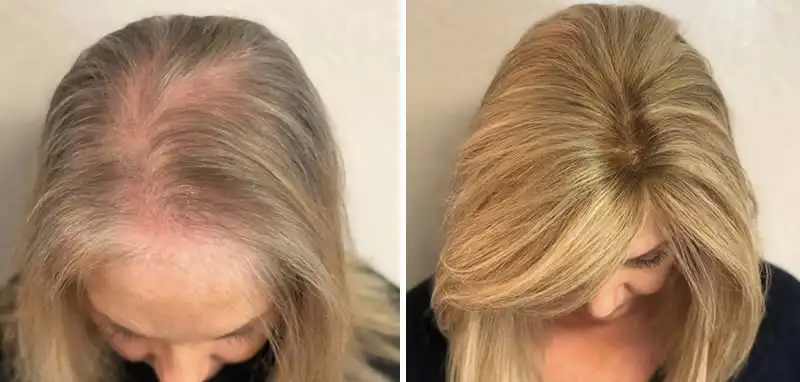 Before and after — Paula D.